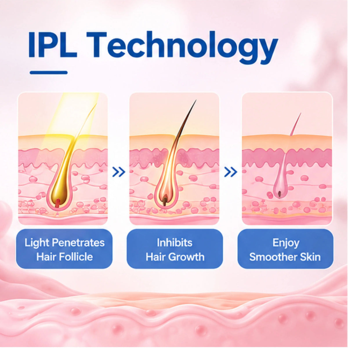 Mini IPL Hair Removal Device – 5 Energy Levels, 2 Modes