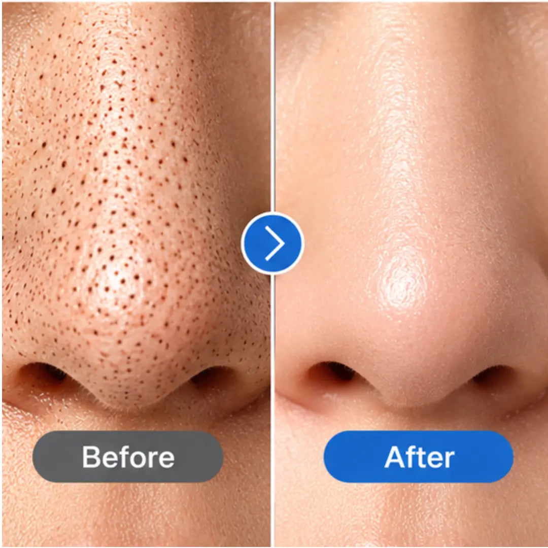 Ultrasonic Face Spatula – Deep Cleansing & Serum Infusion